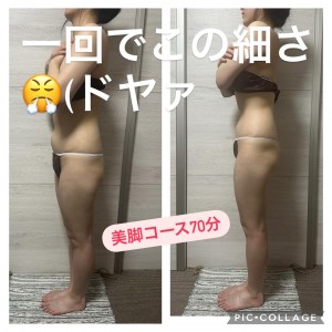 美脚側面左１